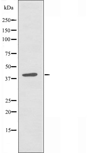 DF3435 staining HuvEc cells by IF/ICC. The sample were fixed with PFA and permeabilized in 0.1% Triton X-100,then blocked in 10% serum for 45 minutes at 25¡ãC. The primary antibody was diluted at 1/200 and incubated with the sample for 1 hour at 37¡ãC. An  Alexa Fluor 594 conjugated goat anti-rabbit IgG (H+L) antibody(Cat.