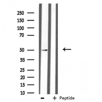 DF3437 staining HepG2 by IF/ICC. The sample were fixed with PFA and permeabilized in 0.1% Triton X-100,then blocked in 10% serum for 45 minutes at 25¡ãC. The primary antibody was diluted at 1/200 and incubated with the sample for 1 hour at 37¡ãC. An  Alexa Fluor 594 conjugated goat anti-rabbit IgG (H+L) Ab, diluted at 1/600, was used as the secondary antibod