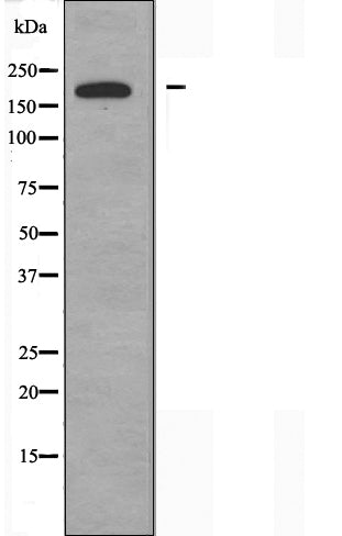 DF3518 at 1/100 staining Mouse kidney tissue by IHC-P. The sample was formaldehyde fixed and a heat mediated antigen retrieval step in citrate buffer was performed. The sample was then blocked and incubated with the antibody for 1.5 hours at 22¡ãC. An HRP conjugated goat anti-rabbit antibody was used as the secondary