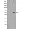 DF3519 staining Hela by IF/ICC. The sample were fixed with PFA and permeabilized in 0.1% Triton X-100,then blocked in 10% serum for 45 minutes at 25¡ãC. The primary antibody was diluted at 1/200 and incubated with the sample for 1 hour at 37¡ãC. An  Alexa Fluor 594 conjugated goat anti-rabbit IgG (H+L) Ab, diluted at 1/600, was used as the secondary antibod