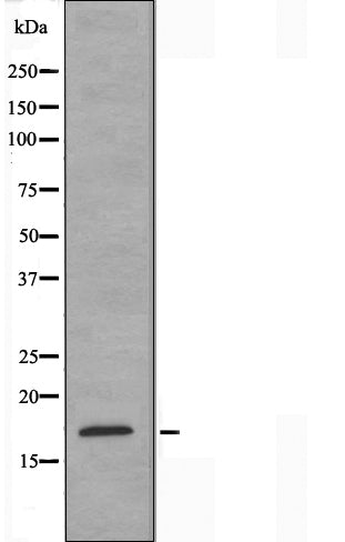 DF3522 staining Hela by IF/ICC. The sample were fixed with PFA and permeabilized in 0.1% Triton X-100,then blocked in 10% serum for 45 minutes at 25¡ãC. The primary antibody was diluted at 1/200 and incubated with the sample for 1 hour at 37¡ãC. An  Alexa Fluor 594 conjugated goat anti-rabbit IgG (H+L) Ab, diluted at 1/600, was used as the secondary antibod