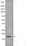 DF3522 staining Hela by IF/ICC. The sample were fixed with PFA and permeabilized in 0.1% Triton X-100,then blocked in 10% serum for 45 minutes at 25¡ãC. The primary antibody was diluted at 1/200 and incubated with the sample for 1 hour at 37¡ãC. An  Alexa Fluor 594 conjugated goat anti-rabbit IgG (H+L) Ab, diluted at 1/600, was used as the secondary antibod