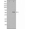 DF3365 at 1/100 staining Human breast cancer tissue by IHC-P. The sample was formaldehyde fixed and a heat mediated antigen retrieval step in citrate buffer was performed. The sample was then blocked and incubated with the antibody for 1.5 hours at 22¡ãC. An HRP conjugated goat anti-rabbit antibody was used as the secondary