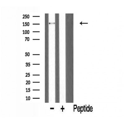 DF3368 staining COLO205 cells by IF/ICC. The sample were fixed with PFA and permeabilized in 0.1% Triton X-100,then blocked in 10% serum for 45 minutes at 25¡ãC. The primary antibody was diluted at 1/200 and incubated with the sample for 1 hour at 37¡ãC. An  Alexa Fluor 594 conjugated goat anti-rabbit IgG (H+L) antibody(Cat.# S0006), diluted at 1/600, was used as secondary antibod