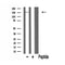 DF3368 staining COLO205 cells by IF/ICC. The sample were fixed with PFA and permeabilized in 0.1% Triton X-100,then blocked in 10% serum for 45 minutes at 25¡ãC. The primary antibody was diluted at 1/200 and incubated with the sample for 1 hour at 37¡ãC. An  Alexa Fluor 594 conjugated goat anti-rabbit IgG (H+L) antibody(Cat.# S0006), diluted at 1/600, was used as secondary antibod