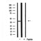 Western blot analysis of extracts from mouse muscle, using DOK4 Antibody.