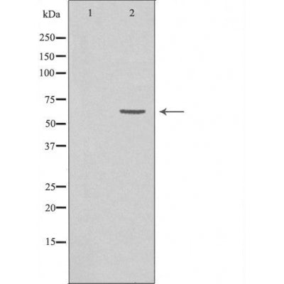 DF3370 staining COLO205 by IF/ICC. The sample were fixed with PFA and permeabilized in 0.1% Triton X-100,then blocked in 10% serum for 45 minutes at 25¡ãC. The primary antibody was diluted at 1/200 and incubated with the sample for 1 hour at 37¡ãC. An  Alexa Fluor 594 conjugated goat anti-rabbit IgG (H+L) Ab, diluted at 1/600, was used as the secondary antibod