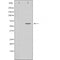 DF3370 staining COLO205 by IF/ICC. The sample were fixed with PFA and permeabilized in 0.1% Triton X-100,then blocked in 10% serum for 45 minutes at 25¡ãC. The primary antibody was diluted at 1/200 and incubated with the sample for 1 hour at 37¡ãC. An  Alexa Fluor 594 conjugated goat anti-rabbit IgG (H+L) Ab, diluted at 1/600, was used as the secondary antibod