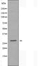 DF3371 staining Hela by IF/ICC. The sample were fixed with PFA and permeabilized in 0.1% Triton X-100,then blocked in 10% serum for 45 minutes at 25¡ãC. The primary antibody was diluted at 1/200 and incubated with the sample for 1 hour at 37¡ãC. An  Alexa Fluor 594 conjugated goat anti-rabbit IgG (H+L) Ab, diluted at 1/600, was used as the secondary antibod