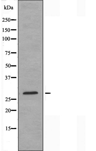 DF3376 at 1/100 staining Mouse liver tissue by IHC-P. The sample was formaldehyde fixed and a heat mediated antigen retrieval step in citrate buffer was performed. The sample was then blocked and incubated with the antibody for 1.5 hours at 22¡ãC. An HRP conjugated goat anti-rabbit antibody was used as the secondary