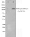 Western blot analysis on HepG2 cell lysate using Phospho-EPHA2/3(Tyr588/596) Antibody,The lane on the left is treated with the antigen-specific peptide.