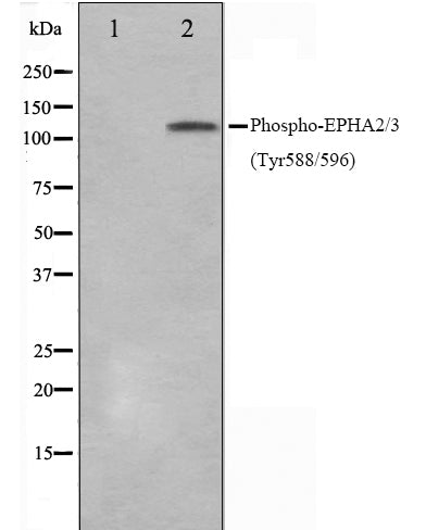 Western blot analysis on HepG2 cell lysate using Phospho-EPHA2/3(Tyr588/596) Antibody,The lane on the left is treated with the antigen-specific peptide.