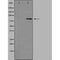 DF3381 staining LOVO by IF/ICC. The sample were fixed with PFA and permeabilized in 0.1% Triton X-100,then blocked in 10% serum for 45 minutes at 25¡ãC. The primary antibody was diluted at 1/200 and incubated with the sample for 1 hour at 37¡ãC. An  Alexa Fluor 594 conjugated goat anti-rabbit IgG (H+L) Ab, diluted at 1/600, was used as the secondary antibod