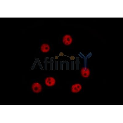 DF3382 staining Hela by IF/ICC. The sample were fixed with PFA and permeabilized in 0.1% Triton X-100,then blocked in 10% serum for 45 minutes at 25¡ãC. The primary antibody was diluted at 1/200 and incubated with the sample for 1 hour at 37¡ãC. An  Alexa Fluor 594 conjugated goat anti-rabbit IgG (H+L) Ab, diluted at 1/600, was used as the secondary antibod