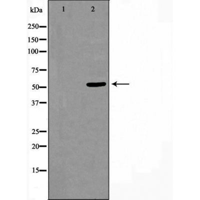 DF3384 staining HeLa cells by IF/ICC. The sample were fixed with PFA and permeabilized in 0.1% Triton X-100,then blocked in 10% serum for 45 minutes at 25¡ãC. The primary antibody was diluted at 1/200 and incubated with the sample for 1 hour at 37¡ãC. An  Alexa Fluor 594 conjugated goat anti-rabbit IgG (H+L) antibody(Cat.# S0006), diluted at 1/600, was used as secondary antibod