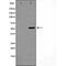 DF3384 staining HeLa cells by IF/ICC. The sample were fixed with PFA and permeabilized in 0.1% Triton X-100,then blocked in 10% serum for 45 minutes at 25¡ãC. The primary antibody was diluted at 1/200 and incubated with the sample for 1 hour at 37¡ãC. An  Alexa Fluor 594 conjugated goat anti-rabbit IgG (H+L) antibody(Cat.# S0006), diluted at 1/600, was used as secondary antibod