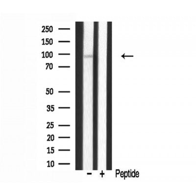 DF3385 staining HepG2 by IF/ICC. The sample were fixed with PFA and permeabilized in 0.1% Triton X-100,then blocked in 10% serum for 45 minutes at 25¡ãC. The primary antibody was diluted at 1/200 and incubated with the sample for 1 hour at 37¡ãC. An  Alexa Fluor 594 conjugated goat anti-rabbit IgG (H+L) Ab, diluted at 1/600, was used as the secondary antibod