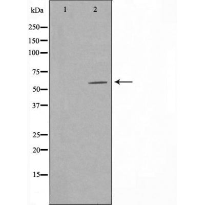 DF3386 staining LOVO cells by IF/ICC. The sample were fixed with PFA and permeabilized in 0.1% Triton X-100,then blocked in 10% serum for 45 minutes at 25¡ãC. The primary antibody was diluted at 1/200 and incubated with the sample for 1 hour at 37¡ãC. An  Alexa Fluor 594 conjugated goat anti-rabbit IgG (H+L) antibody(Cat.# S0006), diluted at 1/600, was used as secondary antibod
