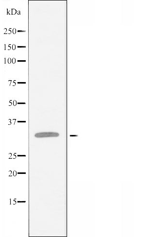DF3387 staining COLO205 cells by IF/ICC. The sample were fixed with PFA and permeabilized in 0.1% Triton X-100,then blocked in 10% serum for 45 minutes at 25¡ãC. The primary antibody was diluted at 1/200 and incubated with the sample for 1 hour at 37¡ãC. An  Alexa Fluor 594 conjugated goat anti-rabbit IgG (H+L) antibody(Cat.# S0006), diluted at 1/600, was used as secondary antibod