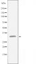 DF3387 staining COLO205 cells by IF/ICC. The sample were fixed with PFA and permeabilized in 0.1% Triton X-100,then blocked in 10% serum for 45 minutes at 25¡ãC. The primary antibody was diluted at 1/200 and incubated with the sample for 1 hour at 37¡ãC. An  Alexa Fluor 594 conjugated goat anti-rabbit IgG (H+L) antibody(Cat.# S0006), diluted at 1/600, was used as secondary antibod