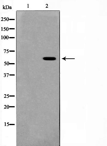 Western blot analysis on Jurkat cell lysate using Phospho-ERK8(Thr175+Tyr177) Antibody,The lane on the left is treated with the antigen-specific peptide.