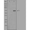DF3388 at 1/100 staining Human breast cancer tissue by IHC-P. The sample was formaldehyde fixed and a heat mediated antigen retrieval step in citrate buffer was performed. The sample was then blocked and incubated with the antibody for 1.5 hours at 22¡ãC. An HRP conjugated goat anti-rabbit antibody was used as the secondary