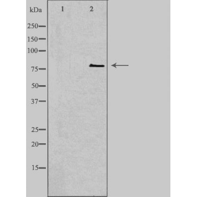 DF3389 staining COLO205 by IF/ICC. The sample were fixed with PFA and permeabilized in 0.1% Triton X-100,then blocked in 10% serum for 45 minutes at 25¡ãC. The primary antibody was diluted at 1/200 and incubated with the sample for 1 hour at 37¡ãC. An  Alexa Fluor 594 conjugated goat anti-rabbit IgG (H+L) Ab, diluted at 1/600, was used as the secondary antibod