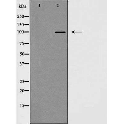 DF3390 staining  HuvEc cells by IF/ICC. The sample were fixed with PFA and permeabilized in 0.1% Triton X-100,then blocked in 10% serum for 45 minutes at 25¡ãC. The primary antibody was diluted at 1/200 and incubated with the sample for 1 hour at 37¡ãC. An  Alexa Fluor 594 conjugated goat anti-rabbit IgG (H+L) antibody(Cat.# S0006), diluted at 1/600, was used as secondary antibod