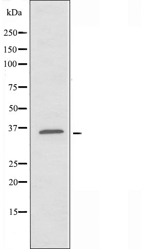 DF3391 at 1/100 staining Human prostate tissue by IHC-P. The sample was formaldehyde fixed and a heat mediated antigen retrieval step in citrate buffer was performed. The sample was then blocked and incubated with the antibody for 1.5 hours at 22¡ãC. An HRP conjugated goat anti-rabbit antibody was used as the secondary