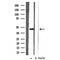DF3394 staining COLO205 by IF/ICC. The sample were fixed with PFA and permeabilized in 0.1% Triton X-100,then blocked in 10% serum for 45 minutes at 25¡ãC. The primary antibody was diluted at 1/200 and incubated with the sample for 1 hour at 37¡ãC. An  Alexa Fluor 594 conjugated goat anti-rabbit IgG (H+L) Ab, diluted at 1/600, was used as the secondary antibod