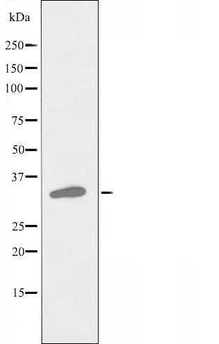 DF3396 staining Hela by IF/ICC. The sample were fixed with PFA and permeabilized in 0.1% Triton X-100,then blocked in 10% serum for 45 minutes at 25¡ãC. The primary antibody was diluted at 1/200 and incubated with the sample for 1 hour at 37¡ãC. An  Alexa Fluor 594 conjugated goat anti-rabbit IgG (H+L) Ab, diluted at 1/600, was used as the secondary antibod