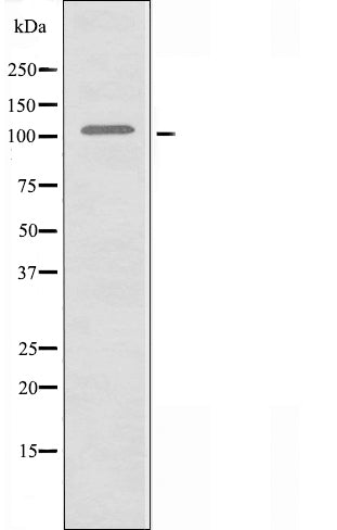 DF3397 staining  HT29 cells by IF/ICC. The sample were fixed with PFA and permeabilized in 0.1% Triton X-100,then blocked in 10% serum for 45 minutes at 25¡ãC. The primary antibody was diluted at 1/200 and incubated with the sample for 1 hour at 37¡ãC. An  Alexa Fluor 594 conjugated goat anti-rabbit IgG (H+L) antibody(Cat.# S0006), diluted at 1/600, was used as secondary antibod