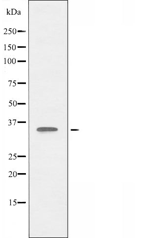 DF3401 staining Hela by IF/ICC. The sample were fixed with PFA and permeabilized in 0.1% Triton X-100,then blocked in 10% serum for 45 minutes at 25¡ãC. The primary antibody was diluted at 1/200 and incubated with the sample for 1 hour at 37¡ãC. An  Alexa Fluor 594 conjugated goat anti-rabbit IgG (H+L) Ab, diluted at 1/600, was used as the secondary antibod