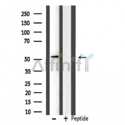 Western blot analysis of extracts from mouse muscle, using IP6K3 Antibody.