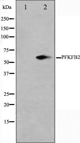 Western blot analysis on 293 cell lysate using PFKFB2 Antibody,The lane on the left is treated with the antigen-specific peptide.