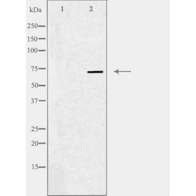 DF3410 staining HepG2 cells by IF/ICC. The sample were fixed with PFA and permeabilized in 0.1% Triton X-100,then blocked in 10% serum for 45 minutes at 25¡ãC. The primary antibody was diluted at 1/200 and incubated with the sample for 1 hour at 37¡ãC. An  Alexa Fluor 594 conjugated goat anti-rabbit IgG (H+L) antibody(Cat.# S0006), diluted at 1/600, was used as secondary antibod