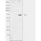 DF3410 staining HepG2 cells by IF/ICC. The sample were fixed with PFA and permeabilized in 0.1% Triton X-100,then blocked in 10% serum for 45 minutes at 25¡ãC. The primary antibody was diluted at 1/200 and incubated with the sample for 1 hour at 37¡ãC. An  Alexa Fluor 594 conjugated goat anti-rabbit IgG (H+L) antibody(Cat.# S0006), diluted at 1/600, was used as secondary antibod