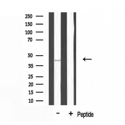 DF3413 at 1/100 staining Rat heart tissue by IHC-P. The sample was formaldehyde fixed and a heat mediated antigen retrieval step in citrate buffer was performed. The sample was then blocked and incubated with the antibody for 1.5 hours at 22¡ãC. An HRP conjugated goat anti-rabbit antibody was used as the secondary