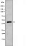 DF3414 staining Hela cells by IF/ICC. The sample were fixed with PFA and permeabilized in 0.1% Triton X-100,then blocked in 10% serum for 45 minutes at 25¡ãC. The primary antibody was diluted at 1/200 and incubated with the sample for 1 hour at 37¡ãC. An  Alexa Fluor 594 conjugated goat anti-rabbit IgG (H+L) antibody(Cat.