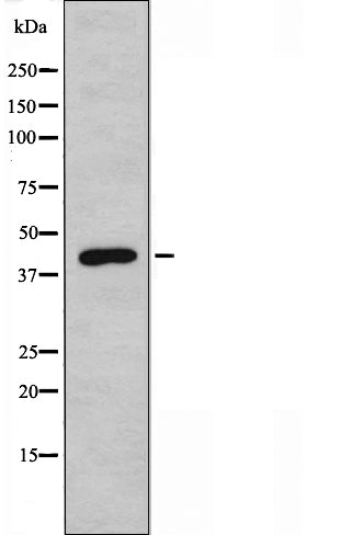 DF3414 staining Hela cells by IF/ICC. The sample were fixed with PFA and permeabilized in 0.1% Triton X-100,then blocked in 10% serum for 45 minutes at 25¡ãC. The primary antibody was diluted at 1/200 and incubated with the sample for 1 hour at 37¡ãC. An  Alexa Fluor 594 conjugated goat anti-rabbit IgG (H+L) antibody(Cat.