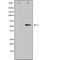 DF3415 staining HuvEc cells by IF/ICC. The sample were fixed with PFA and permeabilized in 0.1% Triton X-100,then blocked in 10% serum for 45 minutes at 25¡ãC. The primary antibody was diluted at 1/200 and incubated with the sample for 1 hour at 37¡ãC. An  Alexa Fluor 594 conjugated goat anti-rabbit IgG (H+L) antibody(Cat.