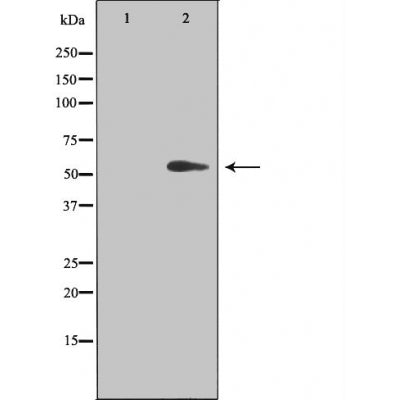 DF3415 staining HuvEc cells by IF/ICC. The sample were fixed with PFA and permeabilized in 0.1% Triton X-100,then blocked in 10% serum for 45 minutes at 25¡ãC. The primary antibody was diluted at 1/200 and incubated with the sample for 1 hour at 37¡ãC. An  Alexa Fluor 594 conjugated goat anti-rabbit IgG (H+L) antibody(Cat.