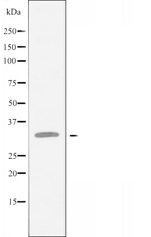 DF3416 staining  Hela cells by IF/ICC. The sample were fixed with PFA and permeabilized in 0.1% Triton X-100,then blocked in 10% serum for 45 minutes at 25¡ãC. The primary antibody was diluted at 1/200 and incubated with the sample for 1 hour at 37¡ãC. An  Alexa Fluor 594 conjugated goat anti-rabbit IgG (H+L) antibody(Cat.# S0006), diluted at 1/600, was used as secondary antibod
