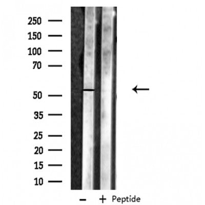 DF3417 staining  HeLa cells by IF/ICC. The sample were fixed with PFA and permeabilized in 0.1% Triton X-100,then blocked in 10% serum for 45 minutes at 25¡ãC. The primary antibody was diluted at 1/200 and incubated with the sample for 1 hour at 37¡ãC. An  Alexa Fluor 594 conjugated goat anti-rabbit IgG (H+L) antibody(Cat.# S0006), diluted at 1/600, was used as secondary antibod