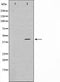 Western blot analysis on HT29 cell lysate using TBX10 Antibody,The lane on the left is treated with the antigen-specific peptide.