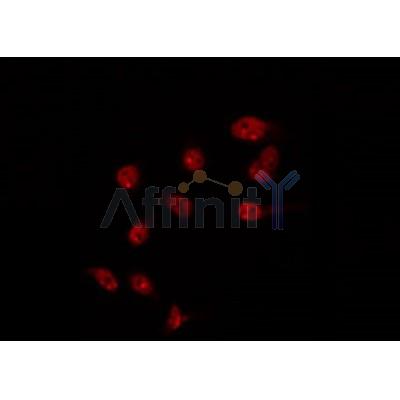 AF0345 staining HT29 by IF/ICC. The sample were fixed with PFA and permeabilized in 0.1% Triton X-100,then blocked in 10% serum for 45 minutes at 25¡ãC. The primary antibody was diluted at 1/200 and incubated with the sample for 1 hour at 37¡ãC. An  Alexa Fluor 594 conjugated goat anti-rabbit IgG (H+L) Ab, diluted at 1/600, was used as the secondary antibod