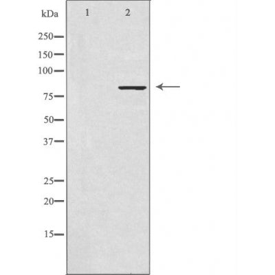 DF3419 staining HuvEc by IF/ICC. The sample were fixed with PFA and permeabilized in 0.1% Triton X-100,then blocked in 10% serum for 45 minutes at 25¡ãC. The primary antibody was diluted at 1/200 and incubated with the sample for 1 hour at 37¡ãC. An  Alexa Fluor 594 conjugated goat anti-rabbit IgG (H+L) Ab, diluted at 1/600, was used as the secondary antibod