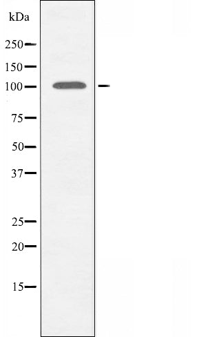 DF3420 staining  HuvEc cells by IF/ICC. The sample were fixed with PFA and permeabilized in 0.1% Triton X-100,then blocked in 10% serum for 45 minutes at 25¡ãC. The primary antibody was diluted at 1/200 and incubated with the sample for 1 hour at 37¡ãC. An  Alexa Fluor 594 conjugated goat anti-rabbit IgG (H+L) antibody(Cat.# S0006), diluted at 1/600, was used as secondary antibod