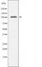 DF3420 staining  HuvEc cells by IF/ICC. The sample were fixed with PFA and permeabilized in 0.1% Triton X-100,then blocked in 10% serum for 45 minutes at 25¡ãC. The primary antibody was diluted at 1/200 and incubated with the sample for 1 hour at 37¡ãC. An  Alexa Fluor 594 conjugated goat anti-rabbit IgG (H+L) antibody(Cat.# S0006), diluted at 1/600, was used as secondary antibod