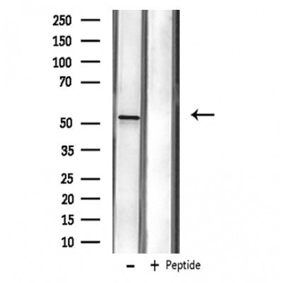 DF3438 staining  Hela cells by IF/ICC. The sample were fixed with PFA and permeabilized in 0.1% Triton X-100,then blocked in 10% serum for 45 minutes at 25¡ãC. The primary antibody was diluted at 1/200 and incubated with the sample for 1 hour at 37¡ãC. An  Alexa Fluor 594 conjugated goat anti-rabbit IgG (H+L) antibody(Cat.# S0006), diluted at 1/600, was used as secondary antibod